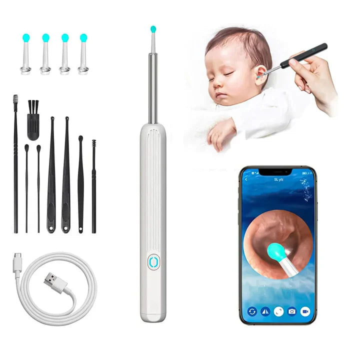 1080P HD Smart Earwax Removal Kit – Safe & Easy Cleaning