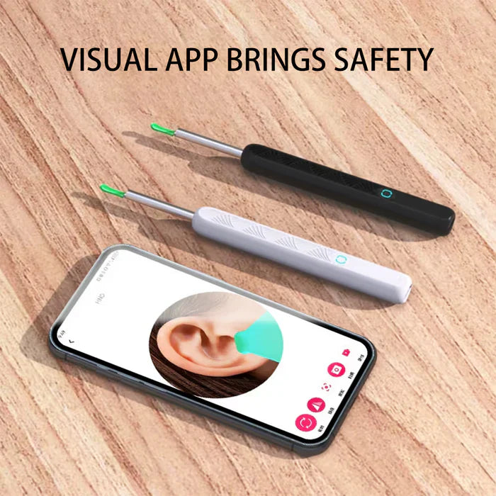 1080P HD Smart Earwax Removal Kit – Safe & Easy Cleaning